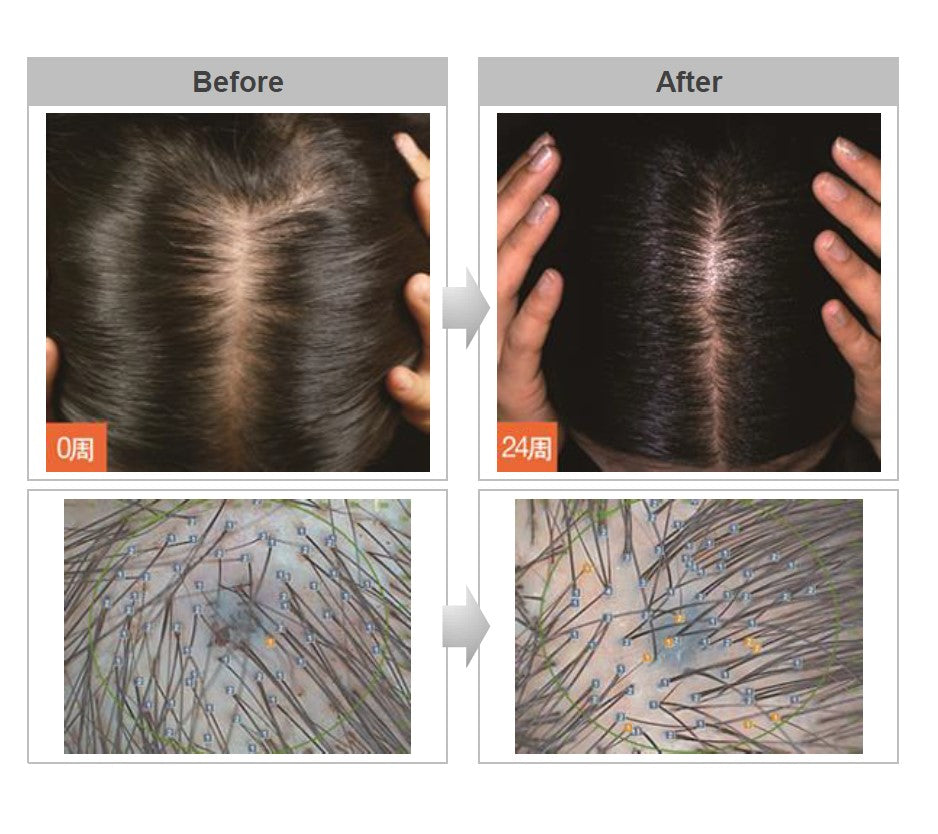 HairBoom Air