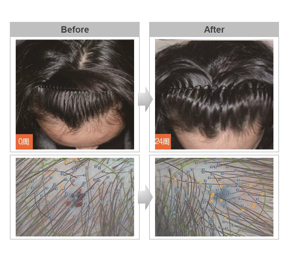 HairBoom Air