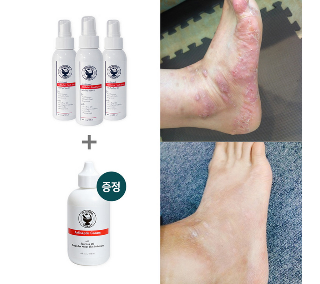 3+1 Bundle Dr. Herbal Therapy Anti-Fungal Athlete's Foot Spray + Antiseptic Cream